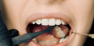 Od talíře k úsměvu: Jak strava ovlivňuje dentální zdraví